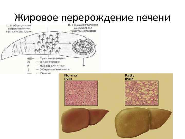 Жировое перерождение тканей