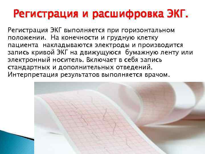 Регистрация и расшифровка ЭКГ. Регистрация ЭКГ выполняется при горизонтальном положении. На конечности и грудную