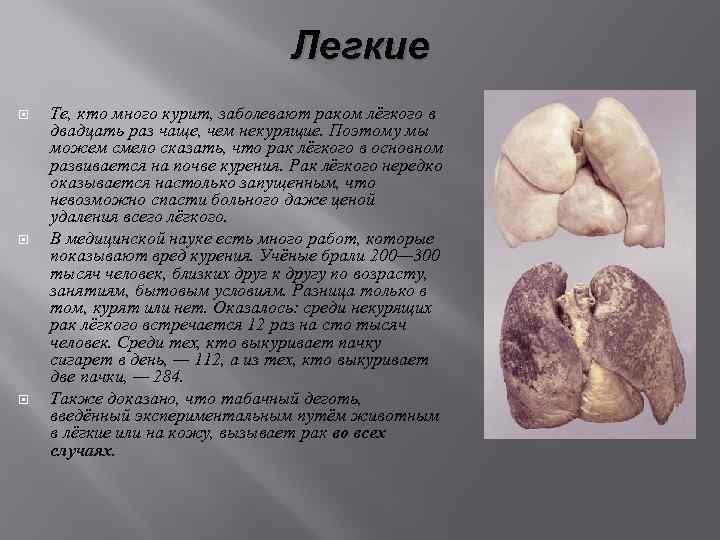 Легкие Те, кто много курит, заболевают раком лёгкого в двадцать раз чаще, чем некурящие.