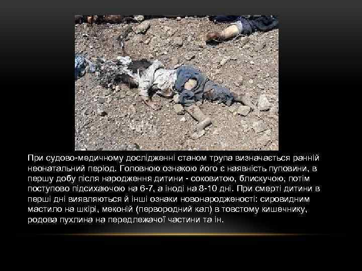 При судово-медичному дослідженні станом трупа визначається ранній неонатальний період. Головною ознакою його є наявність