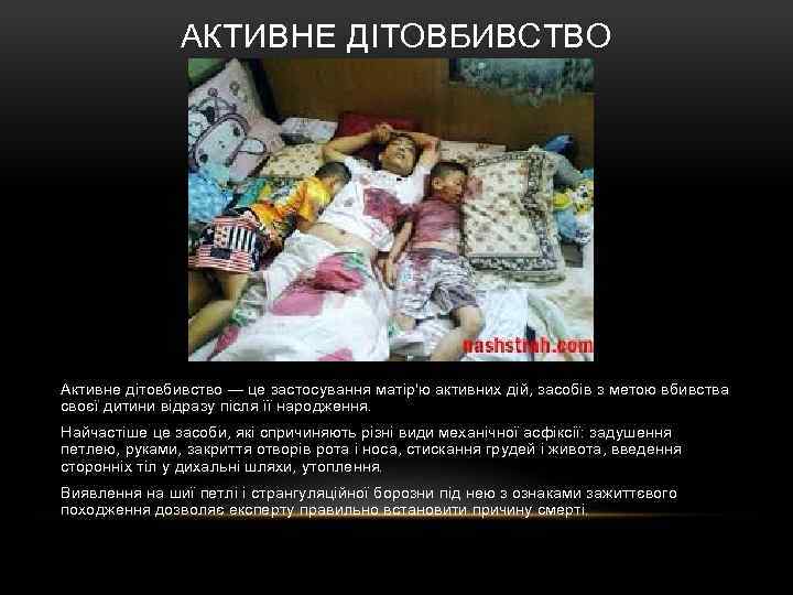 АКТИВНЕ ДІТОВБИВСТВО Активне дітовбивство — це застосування матір'ю активних дій, засобів з метою вбивства