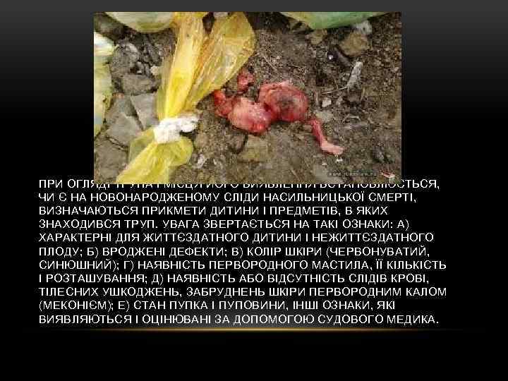 ПРИ ОГЛЯДІ ТРУПА І МІСЦЯ ЙОГО ВИЯВЛЕННЯ ВСТАНОВЛЮЄТЬСЯ, ЧИ Є НА НОВОНАРОДЖЕНОМУ СЛІДИ НАСИЛЬНИЦЬКОЇ