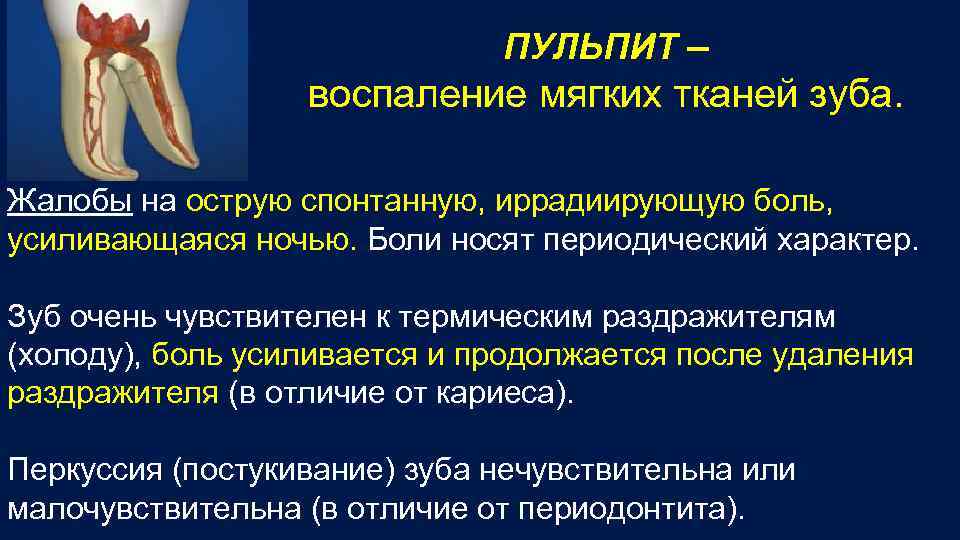 ПУЛЬПИТ – воспаление мягких тканей зуба. Жалобы на острую спонтанную, иррадиирующую боль, усиливающаяся ночью.