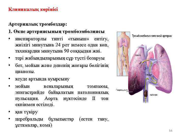 Клиникалық көрінісі Артериялық тромбоздар: 1. Өкпе артериясының тромбоэмболиясы • инспираторлы типті «тыныш» ентігу, жиілігі