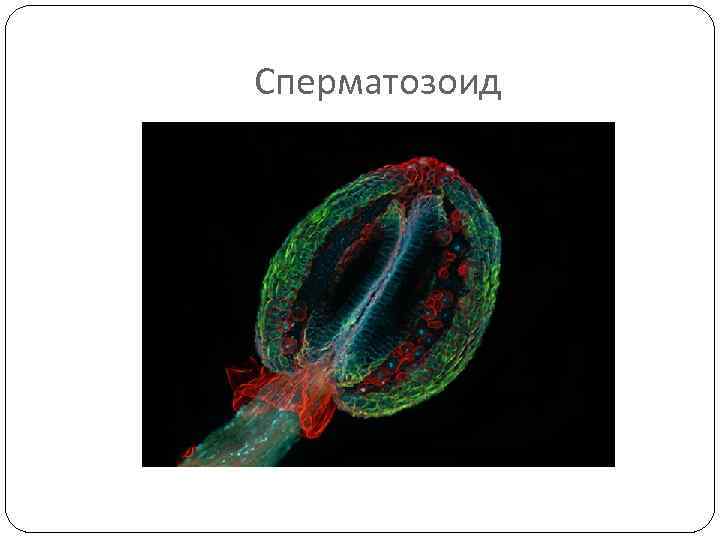 Сперматозоид 