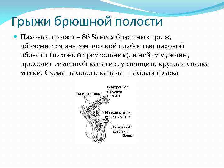Грыжи брюшной полости Паховые грыжи – 86 % всех брюшных грыж, объясняется анатомической слабостью