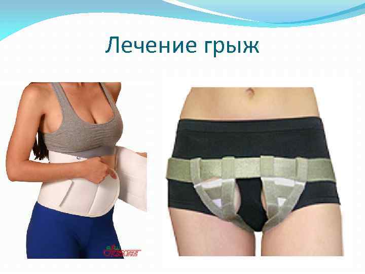 Лечение грыж 