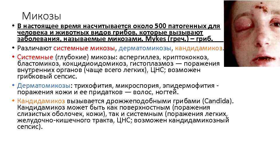 Микозы • В настоящее время насчитывается около 500 патогенных для человека и животных видов