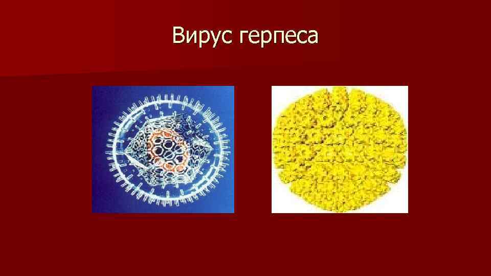 Вирус герпеса 