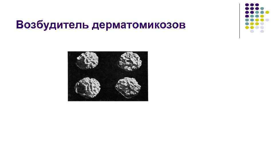 Возбудитель дерматомикозов 