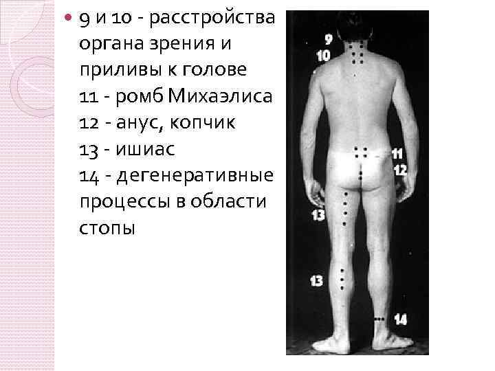  9 и 10 - расстройства органа зрения и приливы к голове 11 -