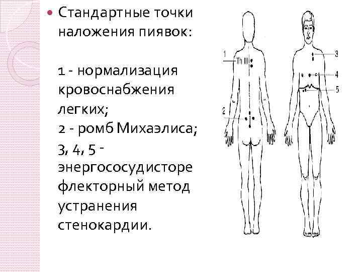 Схема лечения пиявками