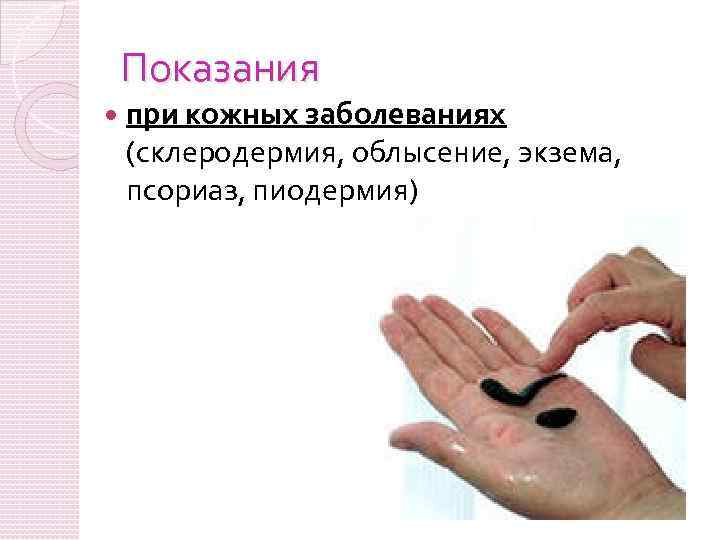Показания при кожных заболеваниях (склеродермия, облысение, экзема, псориаз, пиодермия) 