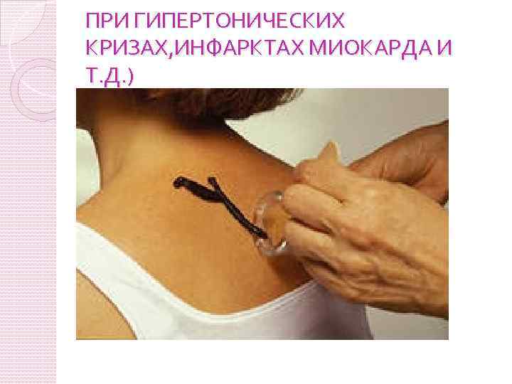 ПРИ ГИПЕРТОНИЧЕСКИХ КРИЗАХ, ИНФАРКТАХ МИОКАРДА И Т. Д. ) 