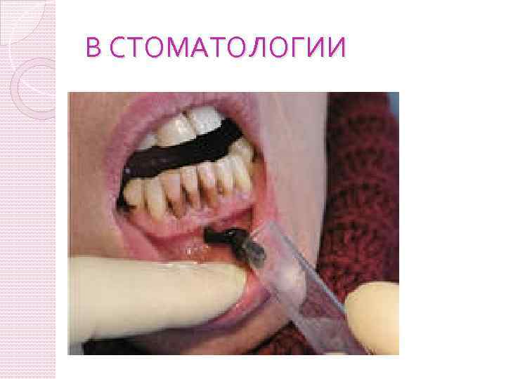 В СТОМАТОЛОГИИ 