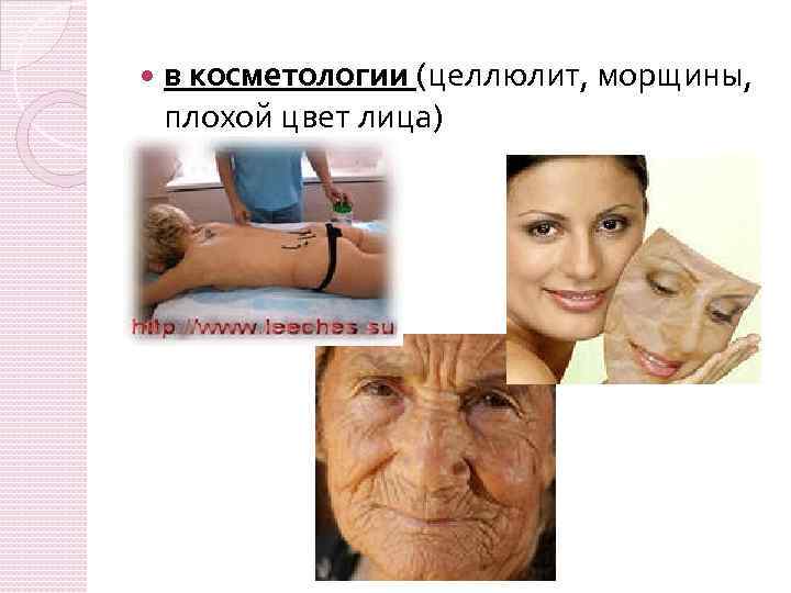  в косметологии (целлюлит, морщины, плохой цвет лица) 
