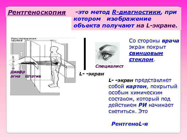 Рентгеноскопия -это метод R-диагностики, при котором изображение объекта получают на L-экране. Со стороны врача