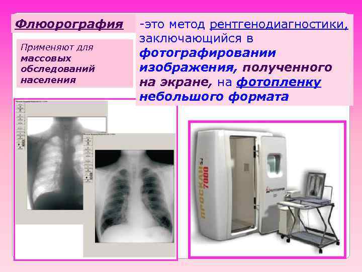 Флюорография Применяют для массовых обследований населения -это метод рентгенодиагностики, заключающийся в фотографировании изображения, полученного