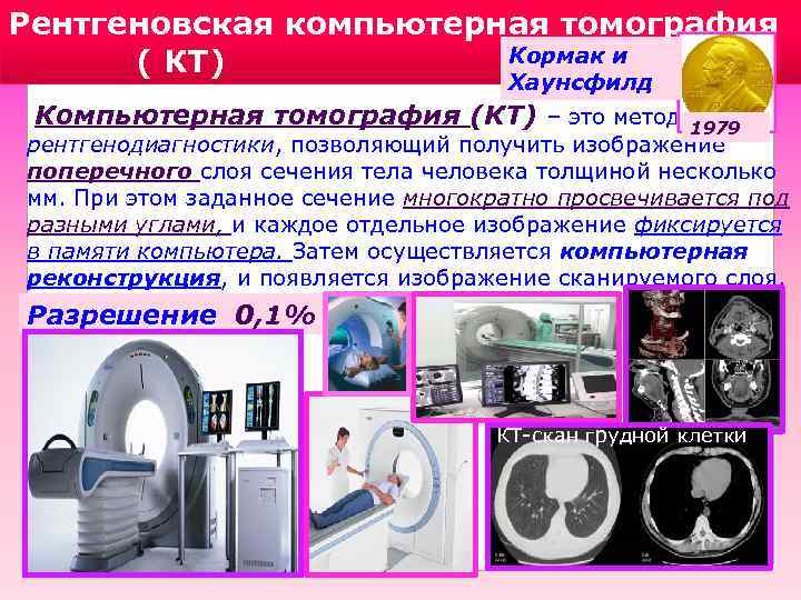 Рентгеновская компьютерная томография Кормак и ( КТ) Хаунсфилд Компьютерная томография (КТ) – это метод