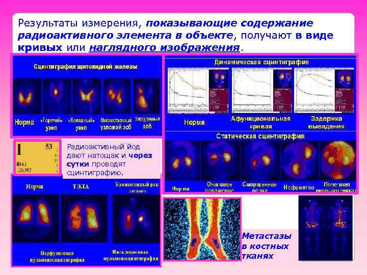 Результаты измерения, показывающие содержание радиоактивного элемента в объекте, получают в виде кривых или наглядного
