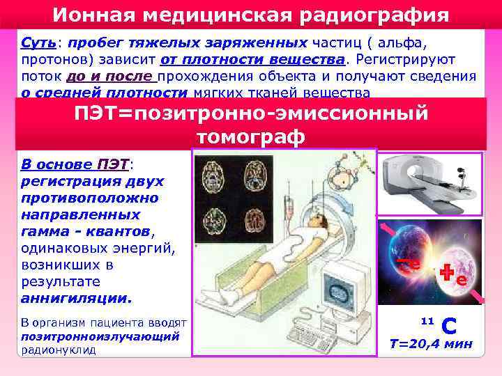 Ионная медицинская радиография Суть: пробег тяжелых заряженных частиц ( альфа, протонов) зависит от плотности