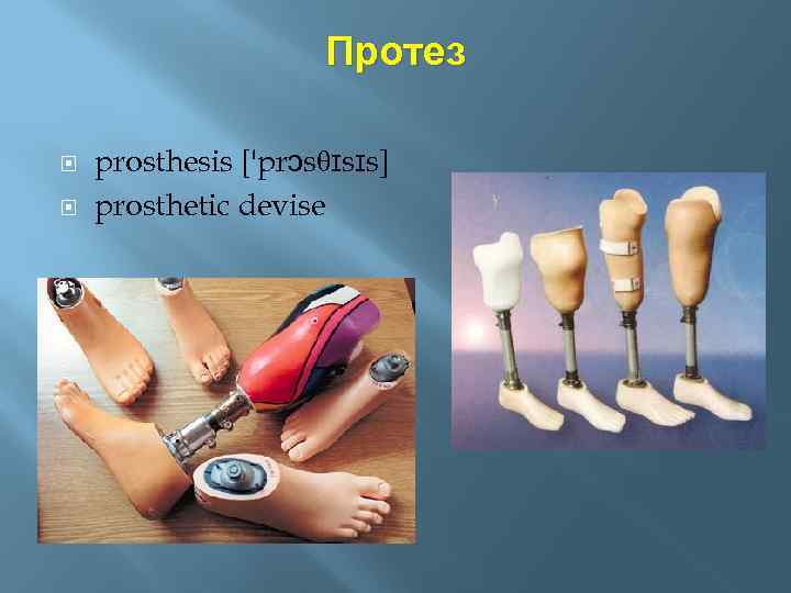 Протез prosthesis ['prɔsθɪsɪs] prosthetic devise 