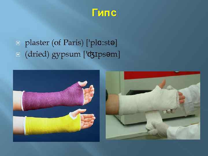 Гипс plaster (of Paris) ['plɑ: stə] (dried) gypsum ['ʤɪpsəm] 