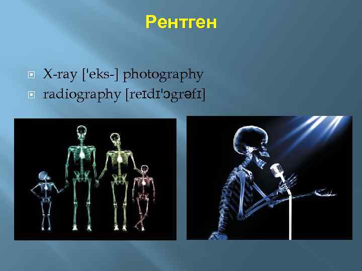 Рентген X-ray ['eks-] photography radiography [reɪdɪ'ɔgrəfɪ] 