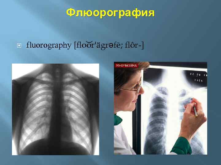 Флюорография fluorography [flo or'ägrəfē; flôr-] 