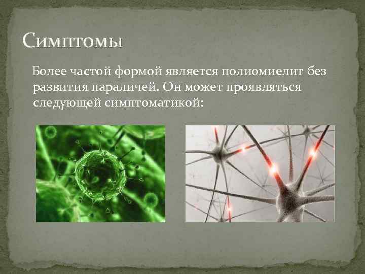 Симптомы Более частой формой является полиомиелит без развития параличей. Он может проявляться следующей симптоматикой: