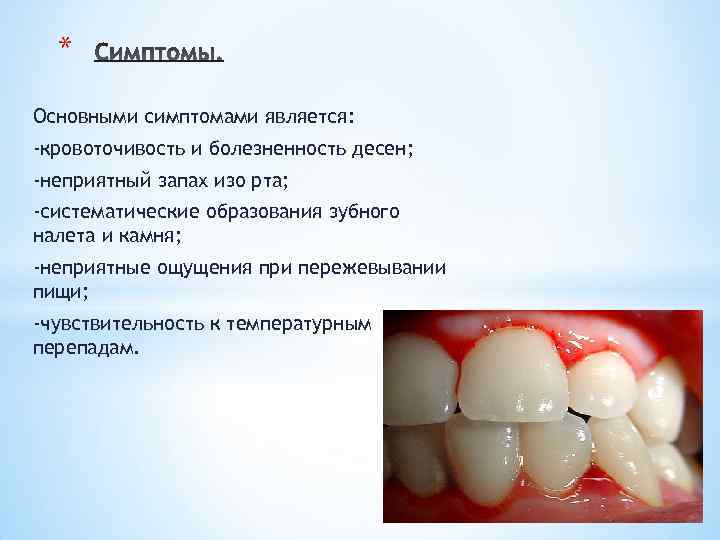 * Основными симптомами является: -кровоточивость и болезненность десен; -неприятный запах изо рта; -систематические образования