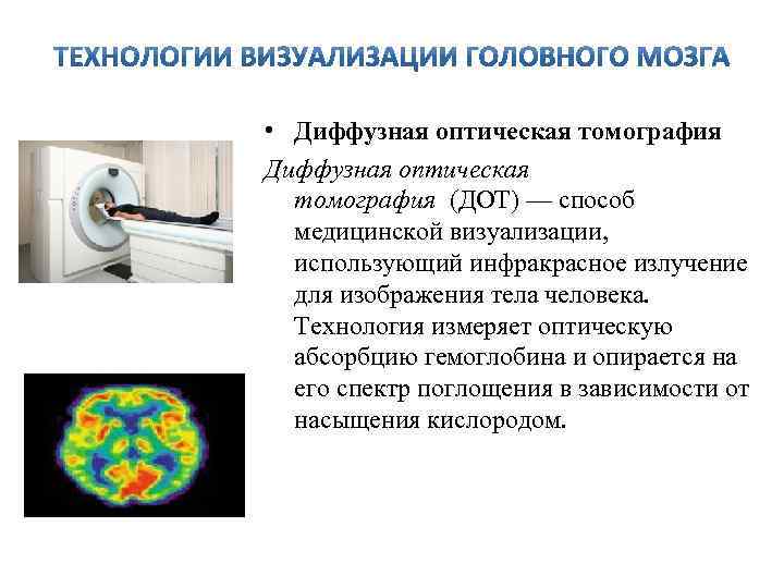  • Диффузная оптическая томография (ДОТ) — способ медицинской визуализации, использующий инфракрасное излучение для