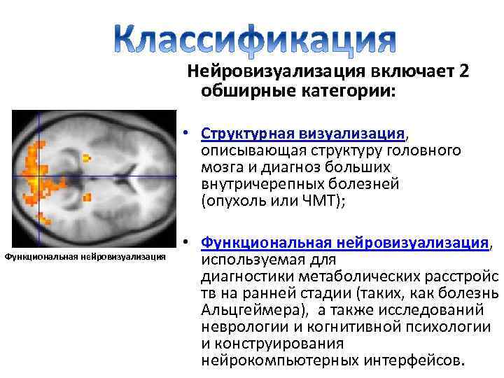  Нейровизуализация включает 2 обширные категории: • Структурная визуализация, описывающая структуру головного мозга и