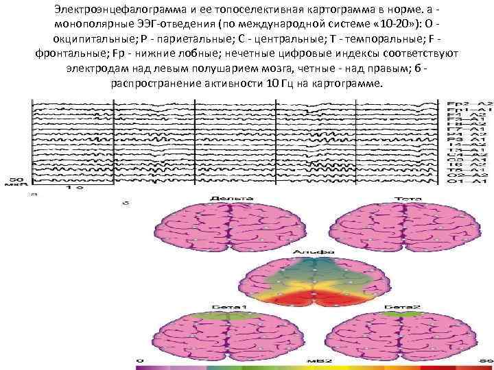 Электроэнцефалограмма и ее топоселективная картограмма в норме. а - монополярные ЭЭГ-отведения (по международной системе