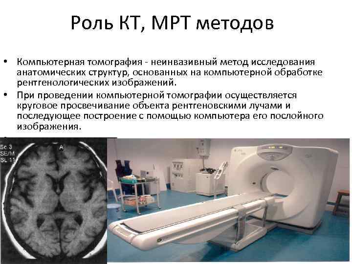 Роль КТ, МРТ методов • Компьютерная томография - неинвазивный метод исследования анатомических структур, основанных