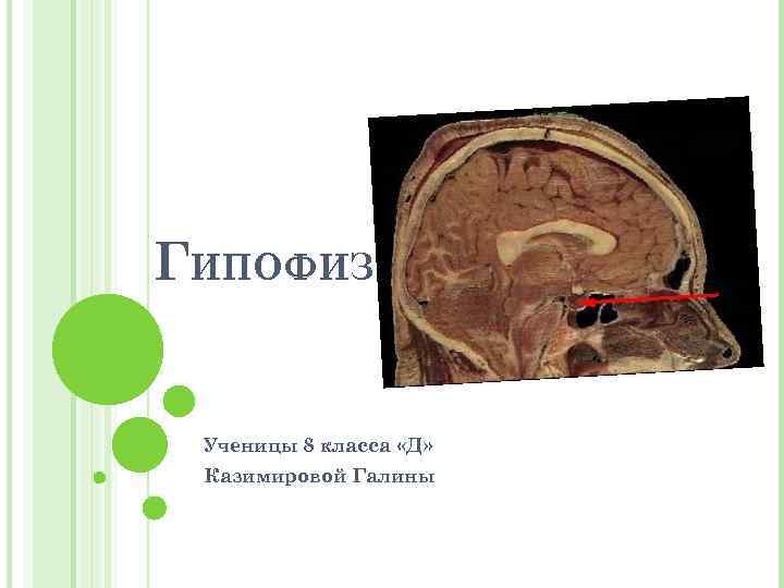 ГИПОФИЗ Ученицы 8 класса «Д» Казимировой Галины 