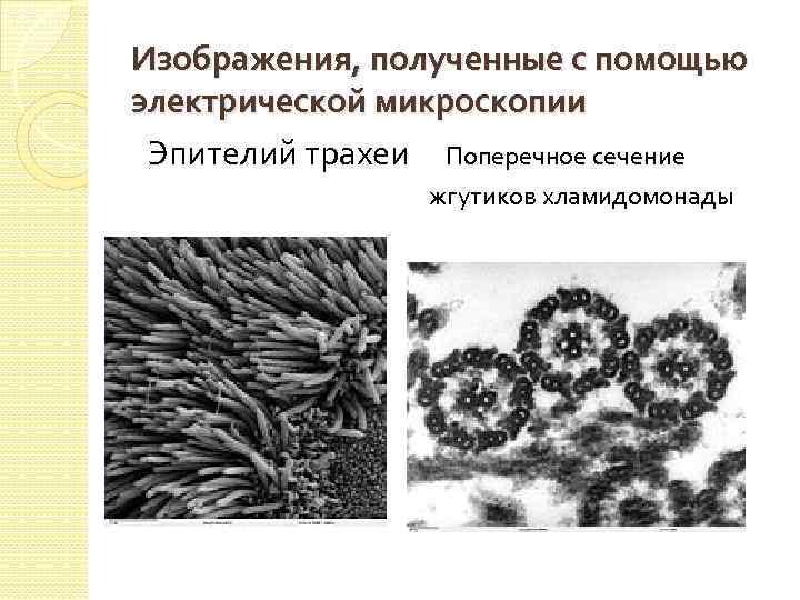 Изображения, полученные с помощью электрической микроскопии Эпителий трахеи Поперечное сечение жгутиков хламидомонады 