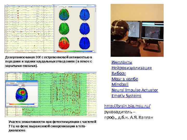 Дезорганизованая ЭЭГ с островолновой активностью в передних и задних каудальных отведениях ( в покое