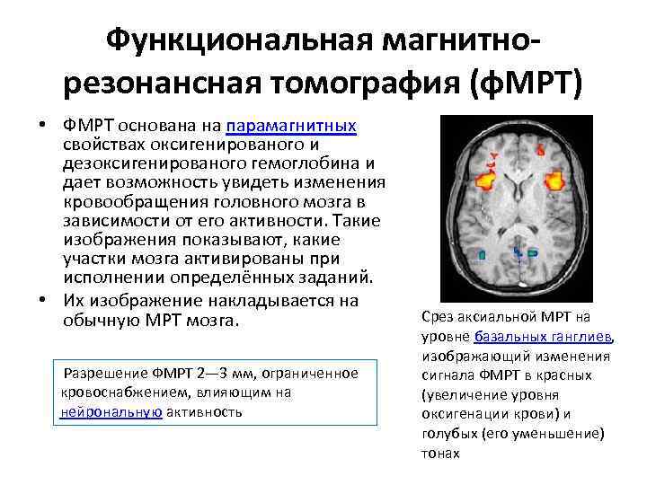 Функциональная магнитнорезонансная томография (ф. МРТ) • ФМРТ основана на парамагнитных свойствах оксигенированого и дезоксигенированого