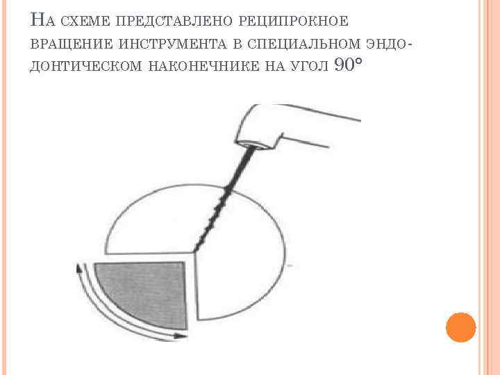 НА СХЕМЕ ПРЕДСТАВЛЕНО РЕЦИПРОКНОЕ ВРАЩЕНИЕ ИНСТРУМЕНТА В СПЕЦИАЛЬНОМ ЭНДОДОНТИЧЕСКОМ НАКОНЕЧНИКЕ НА УГОЛ 90° 