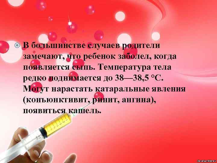  В большинстве случаев родители замечают, что ребенок заболел, когда появляется сыпь. Температура тела