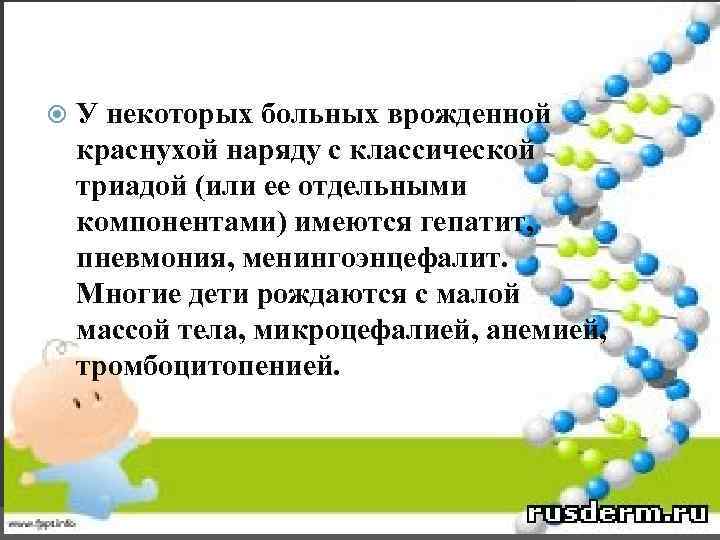  У некоторых больных врожденной краснухой наряду с классической триадой (или ее отдельными компонентами)