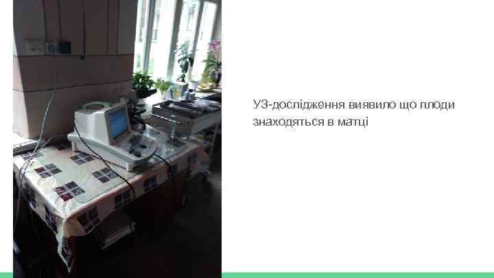 УЗ-дослідження виявило що плоди знаходяться в матці 