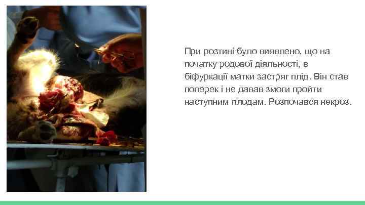 При розтині було виявлено, що на початку родової діяльності, в біфуркації матки застряг плід.