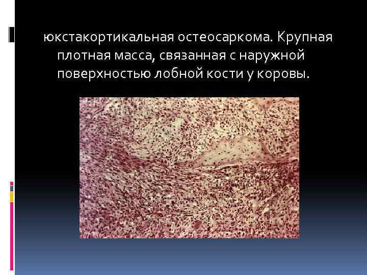 юкстакортикальная остеосаркома. Крупная плотная масса, связанная с наружной поверхностью лобной кости у коровы. 