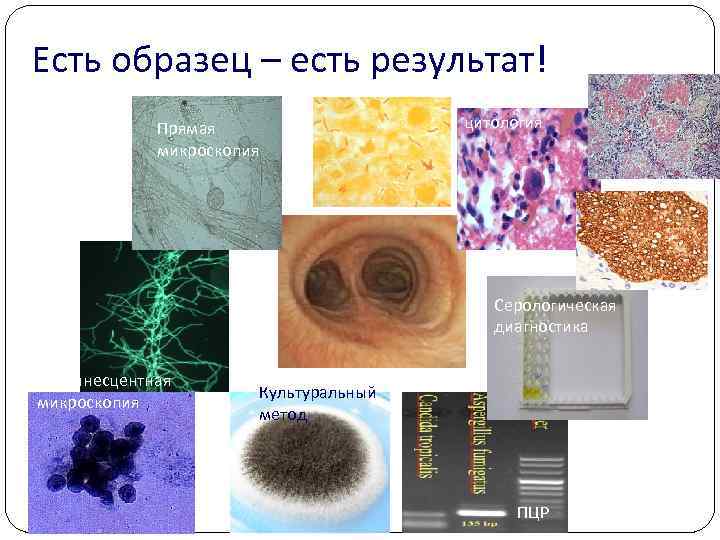 Есть образец – есть результат! Прямая микроскопия цитология Серологическая диагностика Люминесцентная микроскопия Культуральный метод