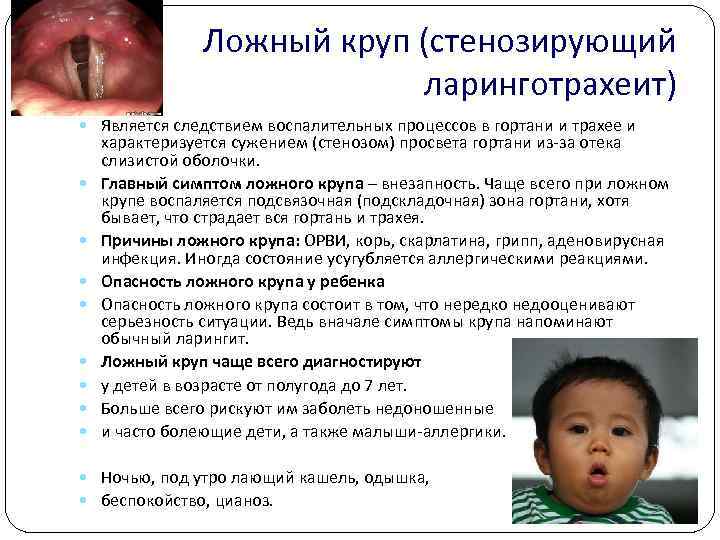 Ложный круп (стенозирующий ларинготрахеит) Является следствием воспалительных процессов в гортани и трахее и характеризуется