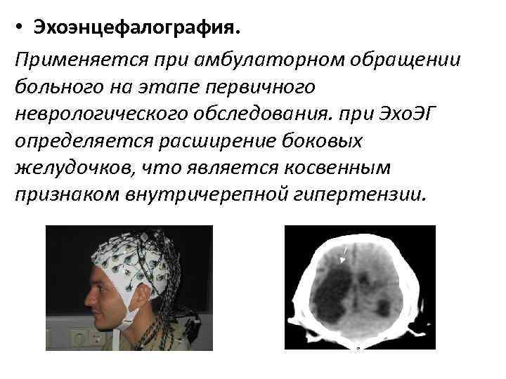  • Эхоэнцефалография. Применяется при амбулаторном обращении больного на этапе первичного неврологического обследования. при