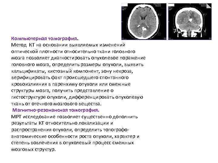 Новейший метод дающий точные и детальные изображения малейших изменений плотности мозгового вещества