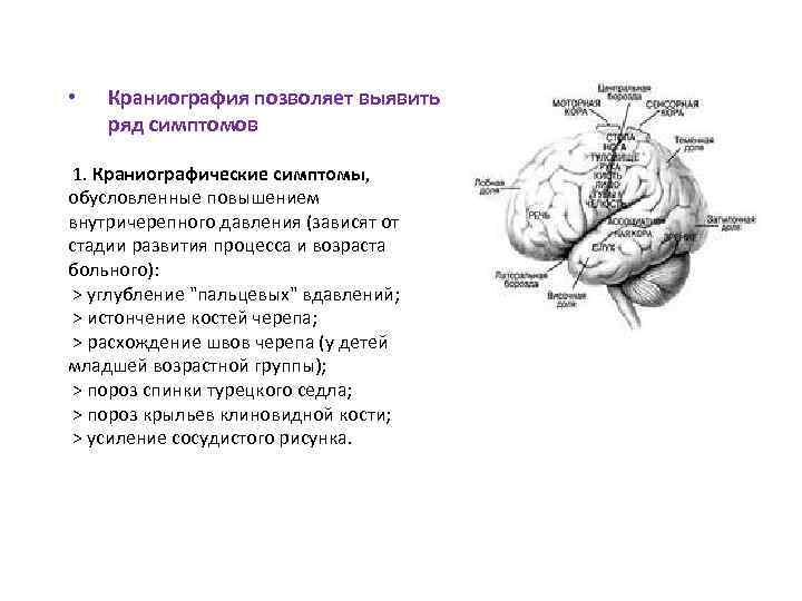  • Краниография позволяет выявить ряд симптомов 1. Краниографические симптомы, обусловленные повышением внутричерепного давления